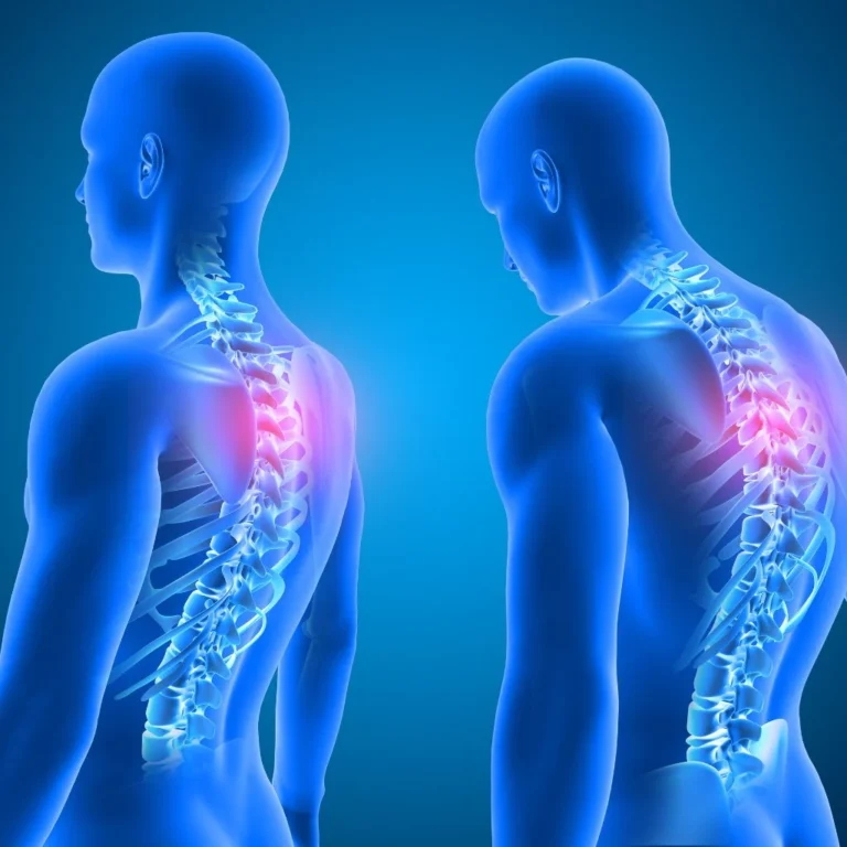 Postural Pain Graphic showing good and poor posture side by side